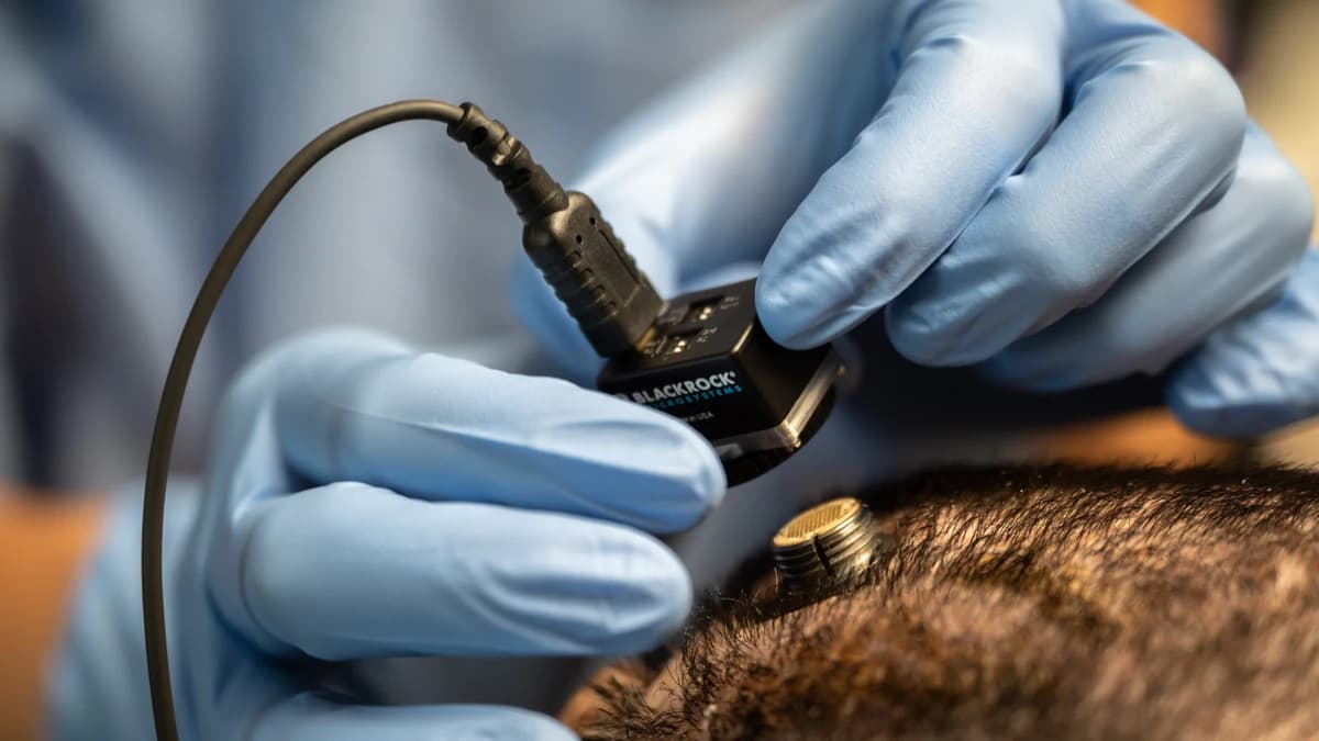Mãos com luvas conectam uma interface a um implante cerebral experimental