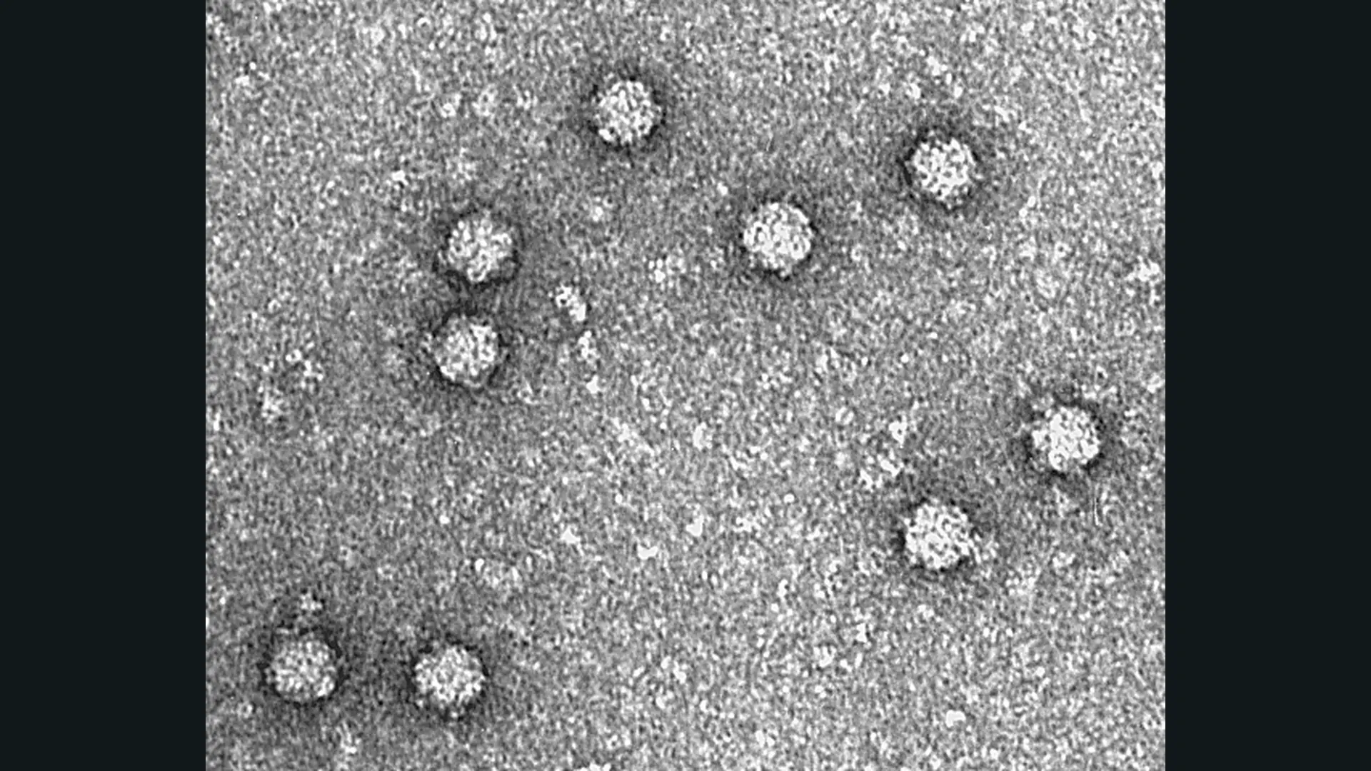 Micrografia eletrônica com partículas do bacteriófago PhiX174